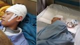 Nam sinh lớp 9 nhập viện điều trị vì bị thầy giáo tát 2 cái