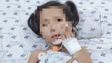Bé gái 7 tuổi mắc căn bệnh lạ đột ngột không nói, không ăn được
