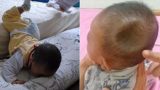 Bé 7 tháng ngã từ trên giường xuống đất nhưng không khóc, ai ngờ tử vong vào ngày hôm sau