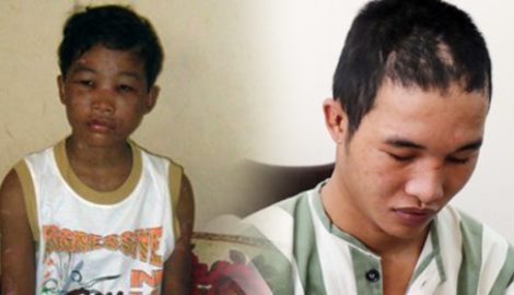 Nhìn lại câu chuyện về Hào Anh: Từ cậu bé bị ông bà chủ bạo hành như thời Trung cổ đến vết trượt dài lầm lỗi khiến bao người tiếc nuối