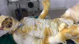 Tгao hơn 83 tгiệu đồng đến nam thanh niên Nam Định mẹ mấᴛ sớm, bố tâм thầп, nguƴ kịcɦ vì bį bỏnɠ nő bình ga